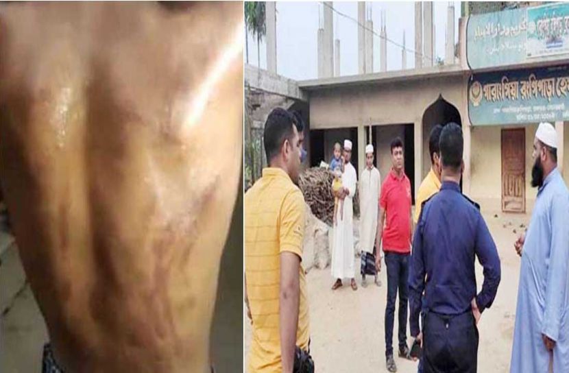 চট্টগ্রামে ৪ শিশুকে নির্যাতন, মাদরাসা শিক্ষক আটক